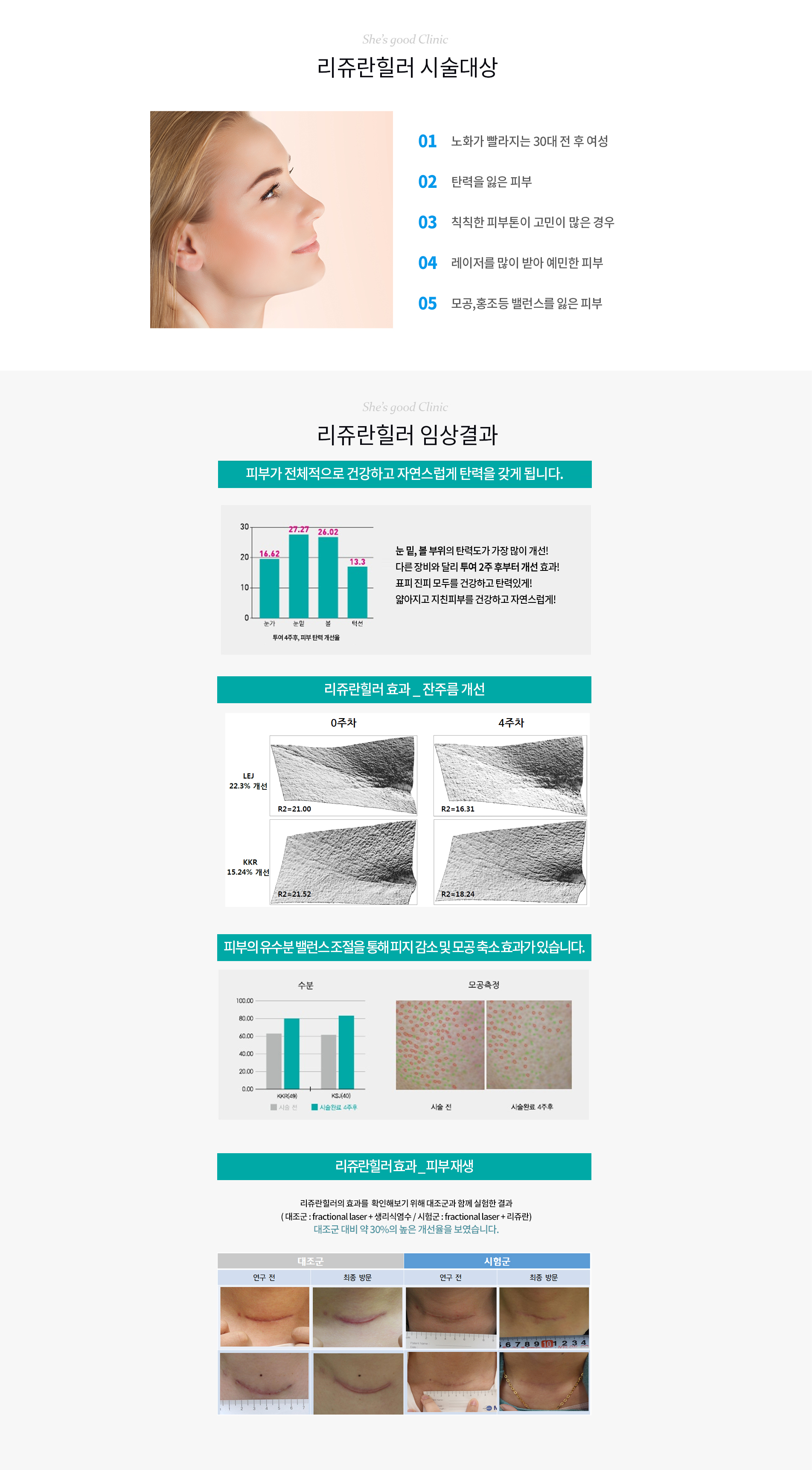 리쥬란힐러