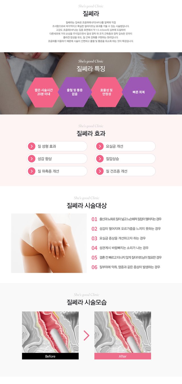 질청결스케일링